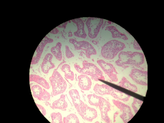 What gland is this? Where is located?