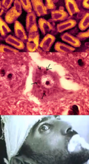 encapsuled
ssRNA -linear
helical

Rabies:
bullet-shaped virus

clinic:
long incubation period (weeks to months) before symptom onset

-->postexposure immunization (passive and active) + wound cleaning

travels to CNS  by migrating in a retrograd...