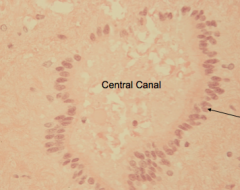 Spinal Cord 10X