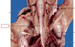 tube extending from the larynx to the lungs through which air is transported during respiration