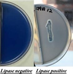 Contains lipids


Spirit blue dye binds to lipids so if there is a break
down of lipids … no dye is present