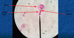 Spermatogenous cells