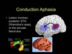 Where would you see problems for CONDUCTION aphasia on the Lichtheim model? What part would be messed up? Why?