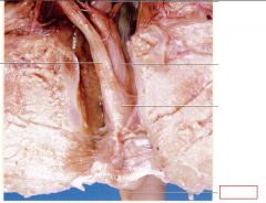 small, fleshy projection next to the urogenital opening of the female fetus