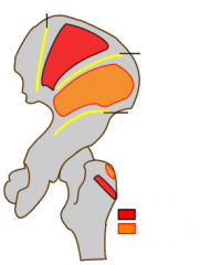 Nævn de tre gluteallinjer på crista glutea, samt de to portrætterede muskler og deres insertion.