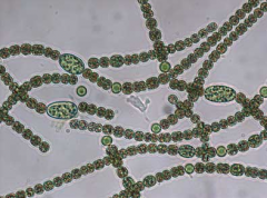 

What Bacteria is this & what are its characteristics?