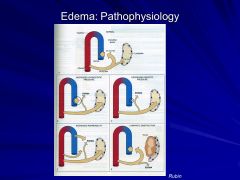 What are 4 conditions that can cause edema?