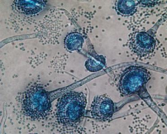 

What Bacteria is this & what are its characteristics?