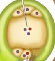 1. Ein Spermakern befruchtet eine Synergide -> Zygote (2n)
2. der andere Spermakern verschmilzt mit den Polkernen und bildet triploiden Endospermkern (3n)
