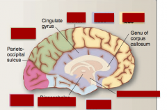 Idenfity occipical lobe, temporal lobe, parietal lobe, frontal lobe, limbic lobe, central sulcus, parieto-occipital sulcus, hpothalamus, thalamus 
