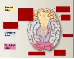 Identify olfactory bulb (CN I), optic nerve (CN II), optic chiasm, temporal pole, midbrain, limbic lobe, occipital pole, sagittal fissure. 
