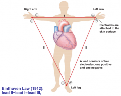 ECG electrodes attach to both arms and the leg form a triangle. Each
two-electrode pair constitutes one lead (pronounced "leed"), which
one positive and one negative electrode. An ECG is recorded from one lead at a
time