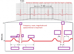 Label this ECG with its waves, intervals and segments: