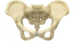 Pelvic Angle: larger in females (usually 100-degree angle or larger)
Pelvic Outlet: Larger in females