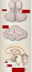Identify vermis, cerebellar hemisphere, cerebellar peduncles, pons, fourth ventricle, cerebellum attachment to pons via peduncles. 