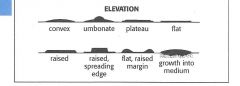 ConvexUmbonate
Plateau
Flat
raised 
raised, spreading edge
flat, raised margin
growth into medium 


