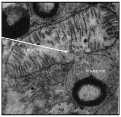 Lysosome releases digestive enzymes into a mitochondria to break down its macromolecules