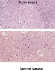 Red neurons
- Lamina 3, 5, and 6
- Putamen
- Caudate nucleus
- Dentate nucleus