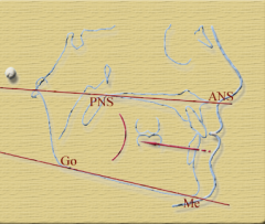 Angle between the Palatal (PNS-ANS) plane and the Mandibular plane. (25 +/- 4 degrees) 

Go= Gonion, Me= Menton) 
PNS=Posterior nasal spine 
ANS=Anterior Nasal Spine