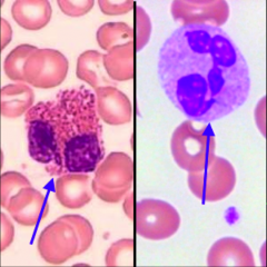 Picture on the front = Eosinophil

Image on left = Eosinophil

Image on right = neutrophil
