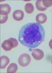 Monocytes
Fair amount of cytoplasm
"Twisted"/convoluted cytoplasm
Cytoplasm lighter coloured/"lacy"
Can't see granules but looks grainy ("ground glass")
Very large, especially compared to the red blood cells