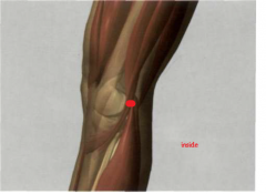 en la porción interna del hueco poplíteo, con la pierna
flexionada, entre los tendones del m. semitendinoso y
el m. semimembranoso