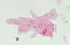 What protozoa is this & what are its characteristics?