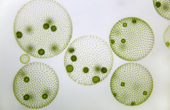 

 What protozoa is this & what are its characteristics?