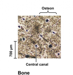 Specialized connective tissue. Bone-forming cells are called osteoblasts that secrete collagen and hydroxyapateite (hardener).