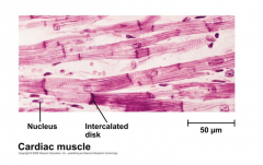 Also striated, but each has a single nucleus and is connected by gap junctions that link with neihbors to produce synchronous contraction. Involuntary (controled by autonomic nervous system.)