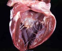 This is a heart from an 11yo dog. What has it got?