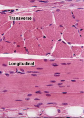 What tissue type is shown?