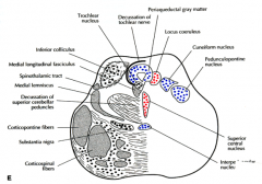 pedunculopontine nucleus