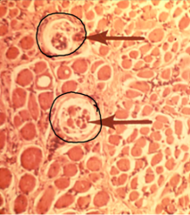 what cells are circled? what type of tissue is surrounding these cells?