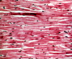 What type of tissue is shown?