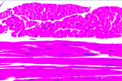 What tissue is shown on top? On bottom?