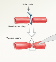 Cutting the wall of a blood vessel trigger a contraction in the smooth muscle fibers of the vessel wall. This local contraction of the vessel is a vascular spasm, which decreased the diameter of the vessel at the site of injury. Such a constrictio...