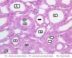Image of Proximal/Distal Convolulated Tubes