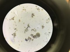 amoeba
trophozoite