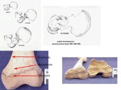 A lot of bones in children fuse to become a single bone
Epiphysial closure indicates end of bone growth, allowing for age of death to be determined by what has and has not fused.
Females typically fuse earlier. 