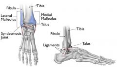 Lateral (fibula) and Medial (tibia) malleolus provide lateral stability to the ankle