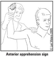 Patient looks apprehensive with gentle shoulder abduction and external rotation to 90 degrees since humeral head is pushed anteriorly and recreates feelings of anterior dislocation