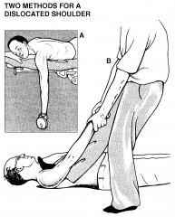 Place heel into patient's axilla and apply traction to arm; perhaps the safest method of shoulder reduction