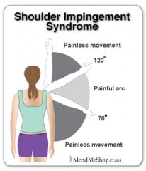 Patient instructed to actively abduct the shoulder; pain with abduction greater than 90 degrees suggests tendinopathy