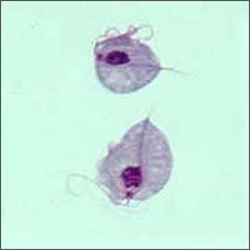 O. Trichomonadida
pathogenic to humans but not severe
sexually transmitted
5 flagella ( 4 anterior)
undulating membrane 
tophs found in urogential tract 
no cyst stage