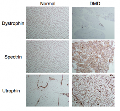Dystrophin: lacking in DMD