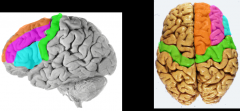 green= precentral gyrus
orange= superior frontal gyri
pink= middle frontal gyri
blue= inferior frontal gyri