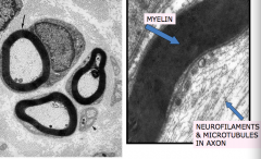 A= myelin
B= neurofilaments and microtubules in axons
