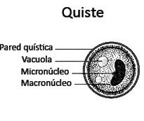 Has a kidney or bean-shaped macronucleus, spherical micronucleus, contractile vacuoles, and retracted cilia