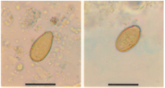 좌에서 우측 나열이 맞는 것은?
1. 간흡충, 요코가와흡충
2. M.yokogawai & C. sinensis